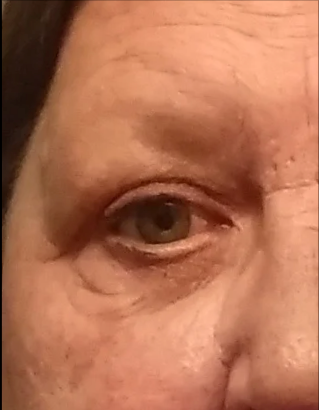 Real Product User after