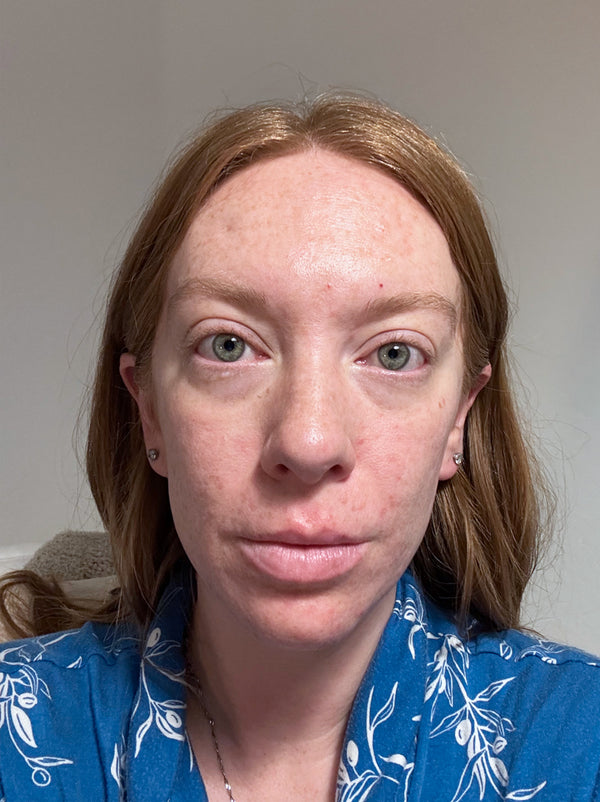 Real Product User after