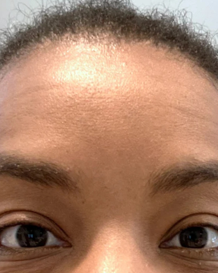 Day 1