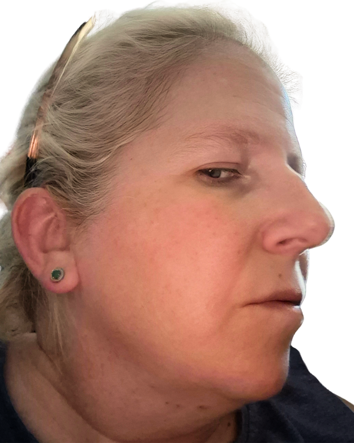 Day 28