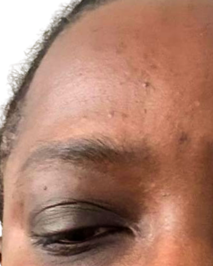 Day 1