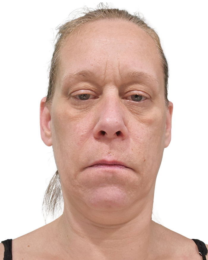 Day 28