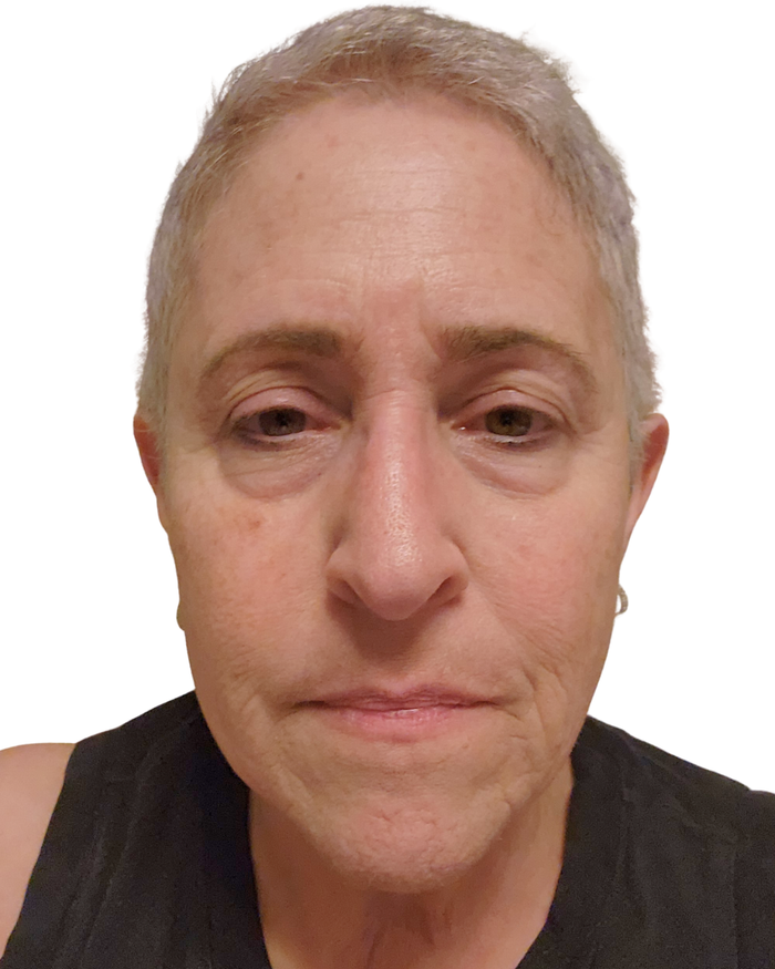 Day 28